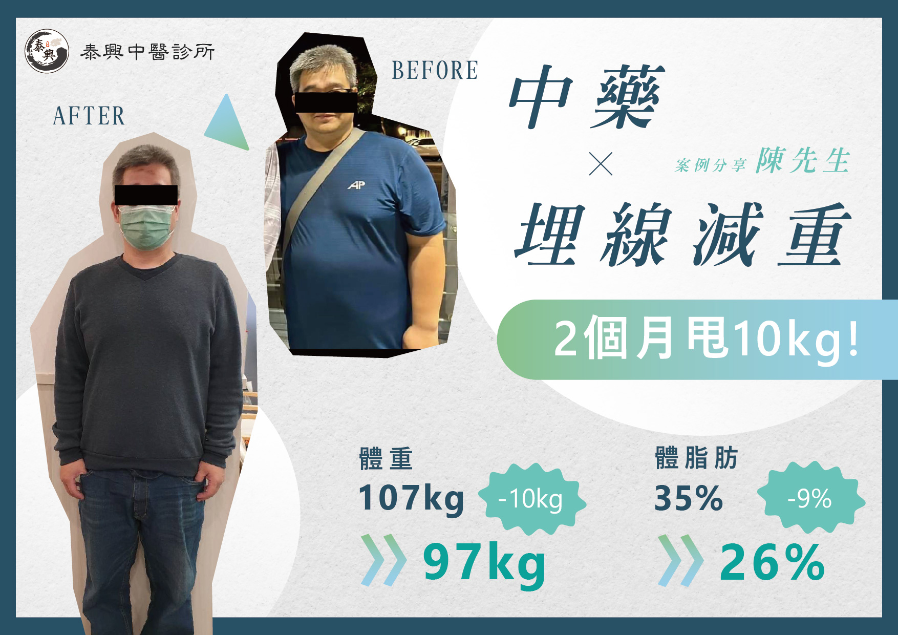 台北埋線減肥