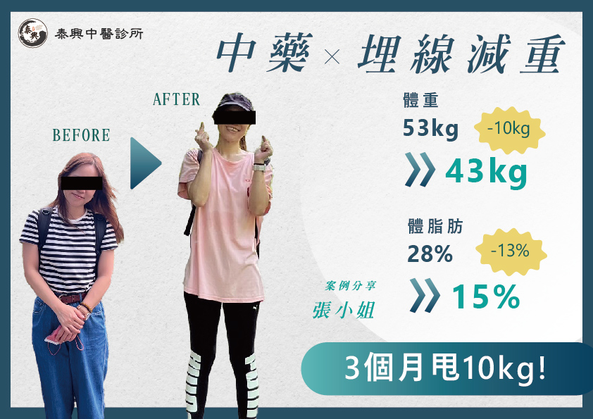 台北埋線減肥