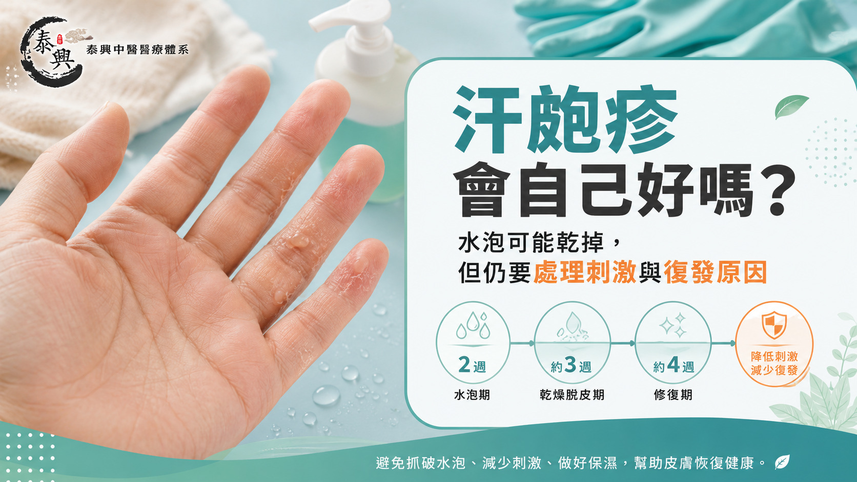 汗皰疹會自己好嗎